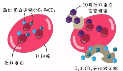 警惕洗澡季隱形殺手 一氧化碳中毒康復(fù)后，當(dāng)心遲發(fā)性腦病